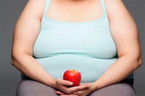 Veenilaiendite ravimiseks peate kaotama ülekaalu